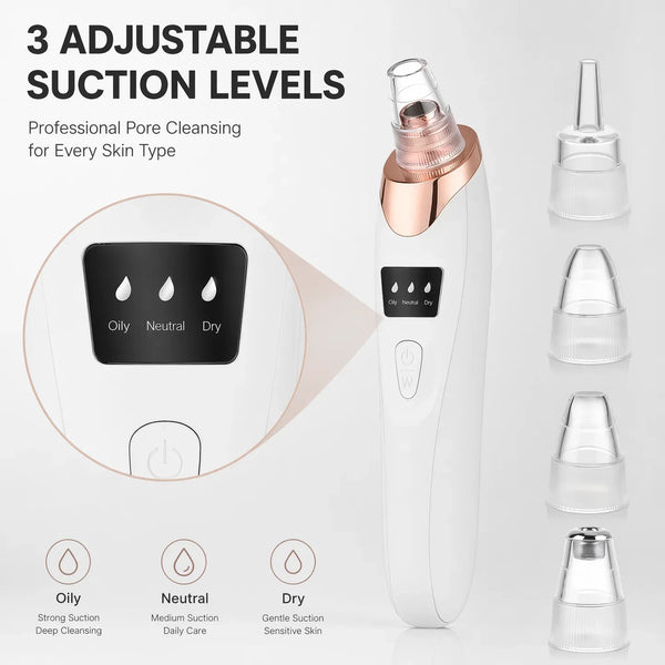 Glow-Up Blackhead Remover